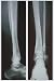 Two Ankles by Unknown. Size 11.40 inches width by 17.61 inches height. High Quality Art Poster Print
