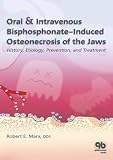 Oral & Intravenous Bisphosphonate-Induced Osteonecrosis of the Jaws: History, Etiology, Prevention, and Treatment