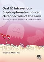 Oral & Intravenous Bisphosphonate-Induced Osteonecrosis of the Jaws: History, Etiology, Prevention, and Treatment
