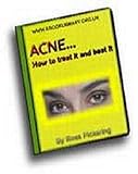 Acne   How to Treat It and Beat It