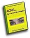 Acne - How to Treat It and Beat It