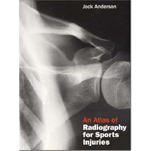 An Atlas of Radiography for Sports Injuries by Jock Anderson