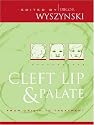 Cleft Lip and Palate: From Origin to Treatment