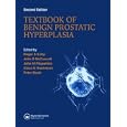 Textbook of Benign Prostatic Hyperplasia, Second Edition