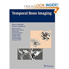 Temporal Bone Imaging by Ellen Hoeffner, Suresh Mukherji, Dheeraj Gandhi and Diana Gomez-Hassan