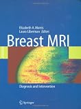 Breast MRI: Diagnosis and Intervention