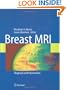 Breast MRI: Diagnosis and Intervention