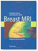 Breast MRI: Diagnosis and Intervention