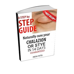 Step by step guide Naturally cure your chalazion or stye in 14 days GUARANTEED