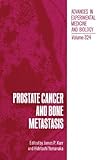 Prostate cancer and bone metastasis