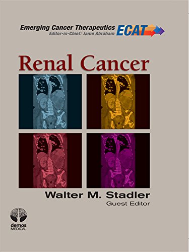 Renal Cancer: ECT (Emerging Cancer Therapeutics)