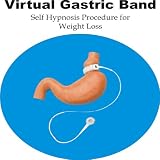 Virtual Gastric Band Operation Procedure for Weight Loss