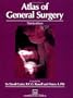 Atlas of General Surgery (Rob & Smith's Operative Surgery)