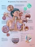 Respiratory Tract Infections Chart
