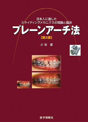 プレーンアーチ法―日本人に適したスライディングメカニクスの理論と臨床のJPEG画像