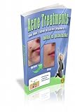 Acne Treatments: You Don't Suffer Anymore