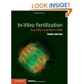In-Vitro Fertilization