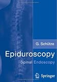 Epiduroscopy: Spinal Endoscopy G. Schutze Springer