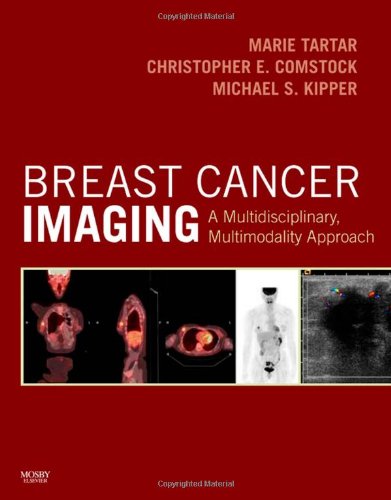 breast cancer imaging a multidisciplinary multimodality approach 1e
