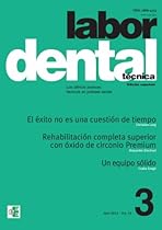 Labor Dental T&eacute;cnica 3-2013 (Spanish Edition)
