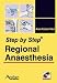 Book Step by Step Regional Anesthesia