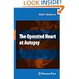 The Operated Heart at Autopsy by Stuart Lair Houser