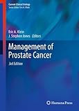 Management of prostate cancer