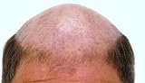 The Whole Bald Truth and Nothing But The Truth