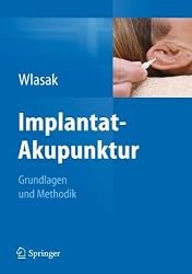 Implantat-Akupunktur: Grundlagen und Methodik (German Edition)