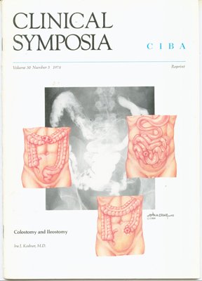 Colostomy