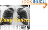 Lung Cancer (WHAT YOU NEED TO KNOW)