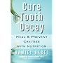 Cure Tooth Decay: Heal and Prevent Cavities with Nutrition: Heal and Prevent Cavities with Nutrition (First Edition)