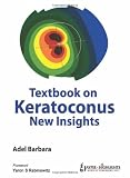 Textbook on Keratoconus New Insights