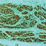 "Glycophorin A - Concentrated Monoclonal Antibodies, Diagnostic BioSystems - Model MOB 066"