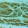 "MART-1/Melan-A (Melanoma Marker) - Concentrated Monoclonal Antibodies, Diagnostic BioSystems"