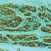 Tau-neurofibrillary Tangles Marker - Concentrated Monoclonal Antibodies, Diagnostic Biosystems