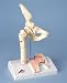 Femoral Fracture and Hip Osteoarthritis