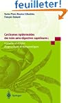 Carcinomes �pidermo�des des voies a�r...