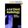 A-Z of Chest Radiology