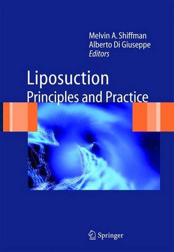 liposuction principles and practice