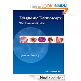 Diagnostic Dermoscopy: The Illustrated Guide