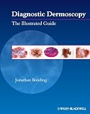 Diagnostic Dermoscopy: The Illustrated Guide
