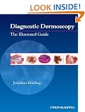 Diagnostic Dermoscopy: The Illustrated Guide