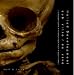 Halted Development - Sub Vitro / Ex Vivo