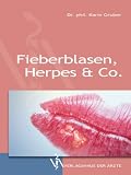 Bild zu: Fieberblasen, Herpes & Co