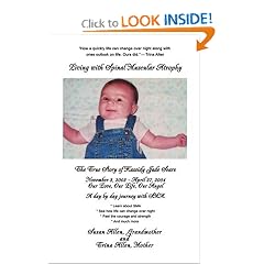 Living with Spinal Muscular Atrophy: The True Story of Kassidy Jade Sears by Trina Allen