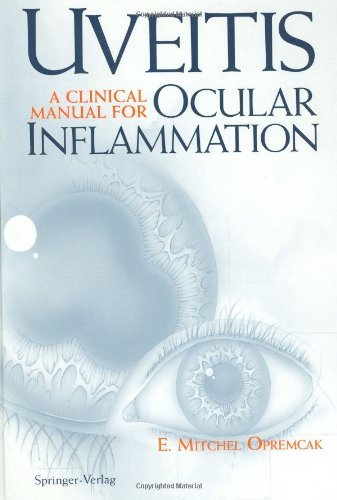 Uveitis: A Clinical Manual for Ocular Inflammation