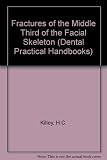 Fractures of the middle third of the facial skeleton
