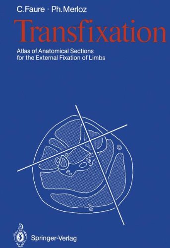 Transfixation: Atlas of Anatomical Sections for the External Fixation of Limbs