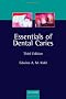 Essentials of Dental Caries: The disease and its management